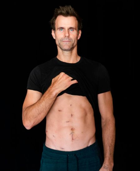 Cameron Mathison poses a picture after his surgery.